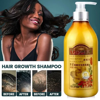 BOQIAN Eski Zencefil şampuan Profesyonel Saç Derisi bakım yağı Kontrol Saç Büyüme Yoğun Anti Saç Dökülmesi Anti Kaşıntı 500 ML