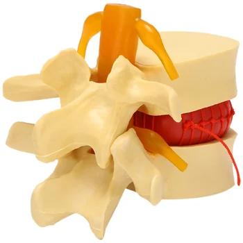 Lomber Vertebra Modeli Anatomik Omurga Lomber Disk Hernisi Anatomi Öğretim Aracı Lomber Vertebra Modeli